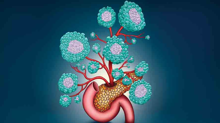 Artistic representation of human embryonic stem cell-derived endocrine-macrophage organoids as flowers. The petals are cells in blue and the centre of the flower is purple. They are in a vase shaped like a pancreas